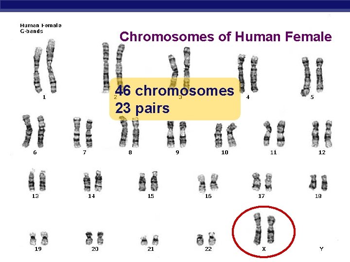 Chromosomes of Human Female 46 chromosomes 23 pairs Regents Biology 