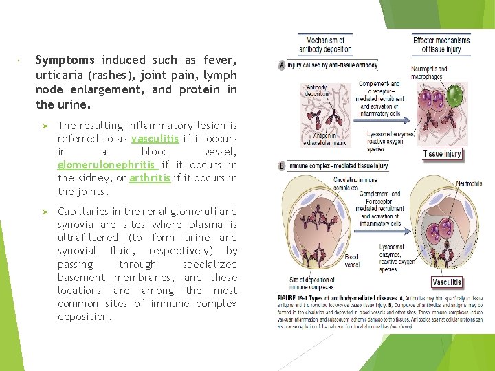  Symptoms induced such as fever, urticaria (rashes), joint pain, lymph node enlargement, and