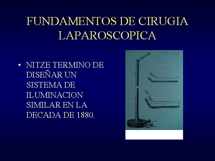 FUNDAMENTOS DE CIRUGIA LAPAROSCOPICA • NITZE TERMINO DE DISEÑAR UN SISTEMA DE ILUMINACION SIMILAR