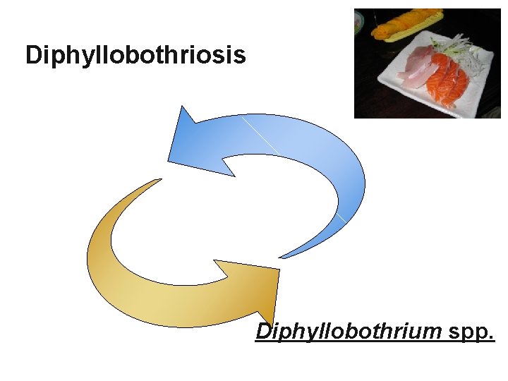 Diphyllobothriosis Diphyllobothrium spp. 