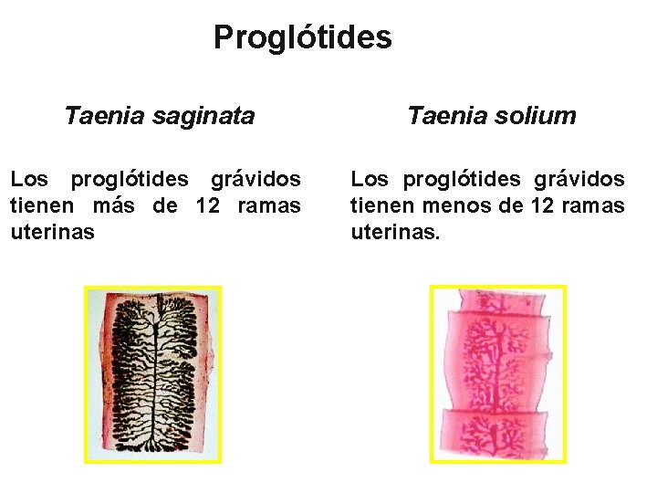 Proglótides Taenia saginata Taenia solium Los proglótides grávidos tienen más de 12 ramas uterinas