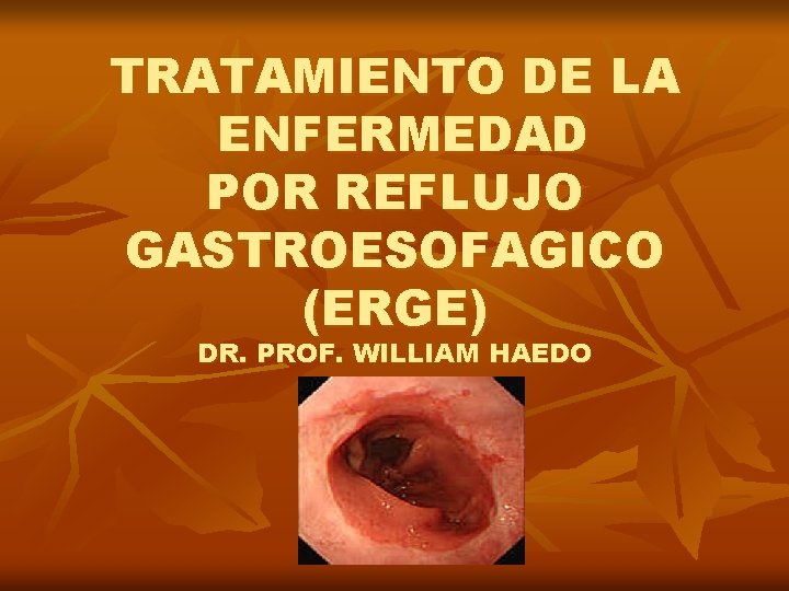 TRATAMIENTO DE LA ENFERMEDAD POR REFLUJO GASTROESOFAGICO (ERGE) DR. PROF. WILLIAM HAEDO 