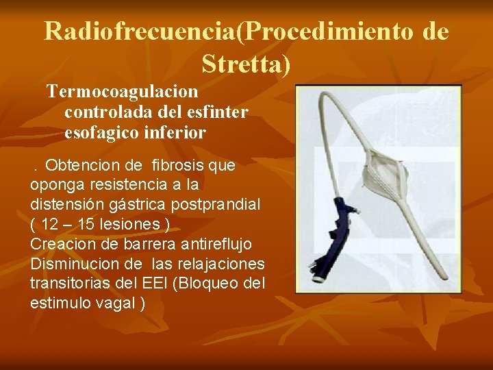 Radiofrecuencia(Procedimiento de Stretta) Termocoagulacion controlada del esfinter esofagico inferior Obtencion de fibrosis que oponga