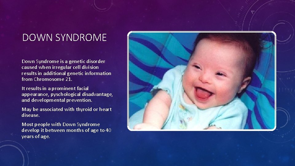 DOWN SYNDROME Down Syndrome is a genetic disorder caused when irregular cell division results