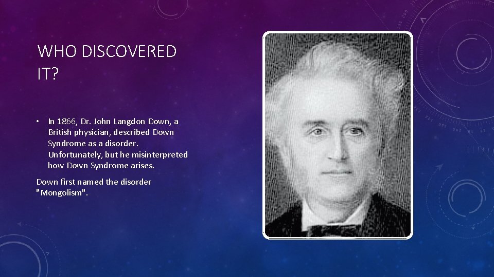 WHO DISCOVERED IT? • In 1866, Dr. John Langdon Down, a British physician, described