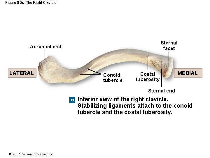 Figure 8 -2 c The Right Clavicle Sternal facet Acromial end LATERAL Conoid tubercle