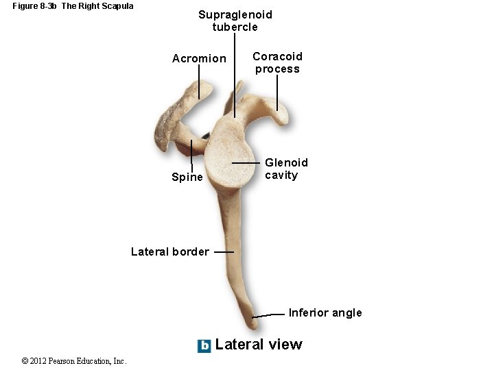 Figure 8 -3 b The Right Scapula Supraglenoid tubercle Acromion Spine Coracoid process Glenoid