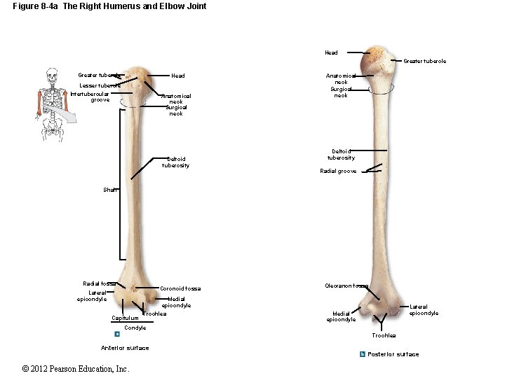 Figure 8 -4 a The Right Humerus and Elbow Joint Head Greater tubercle Head