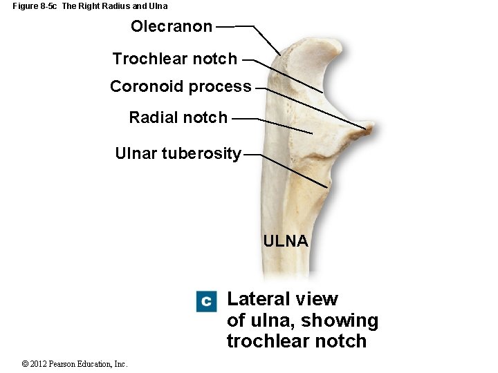 Figure 8 -5 c The Right Radius and Ulna Olecranon Trochlear notch Coronoid process