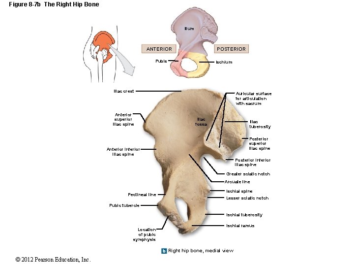 Figure 8 -7 b The Right Hip Bone Ilium ANTERIOR POSTERIOR Pubis Ischium Iliac