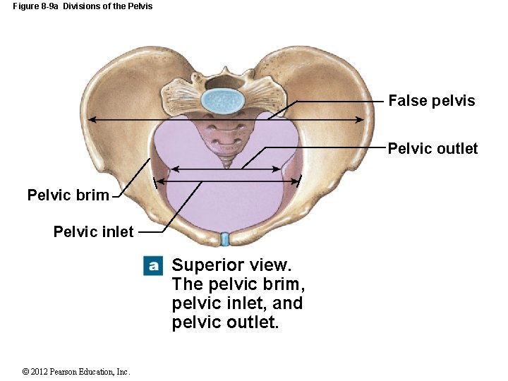 Figure 8 -9 a Divisions of the Pelvis False pelvis Pelvic outlet Pelvic brim