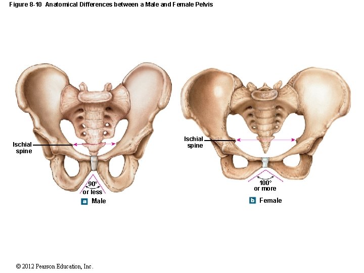 Figure 8 -10 Anatomical Differences between a Male and Female Pelvis Ischial spine 90°