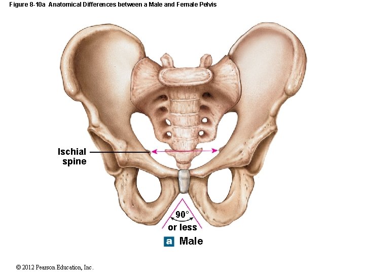 Figure 8 -10 a Anatomical Differences between a Male and Female Pelvis Ischial spine
