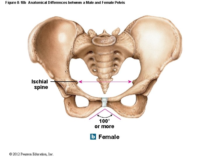 Figure 8 -10 b Anatomical Differences between a Male and Female Pelvis Ischial spine