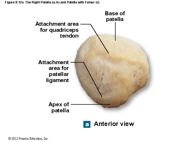 Figure 8 -12 a The Right Patella (a, b) and Patella with Femur (c)