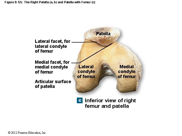 Figure 8 -12 c The Right Patella (a, b) and Patella with Femur (c)