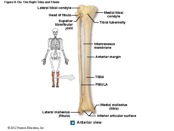 Figure 8 -13 a The Right Tibia and Fibula Lateral tibial condyle Medial tibial