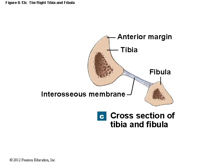 Figure 8 -13 c The Right Tibia and Fibula Anterior margin Tibia Fibula Interosseous