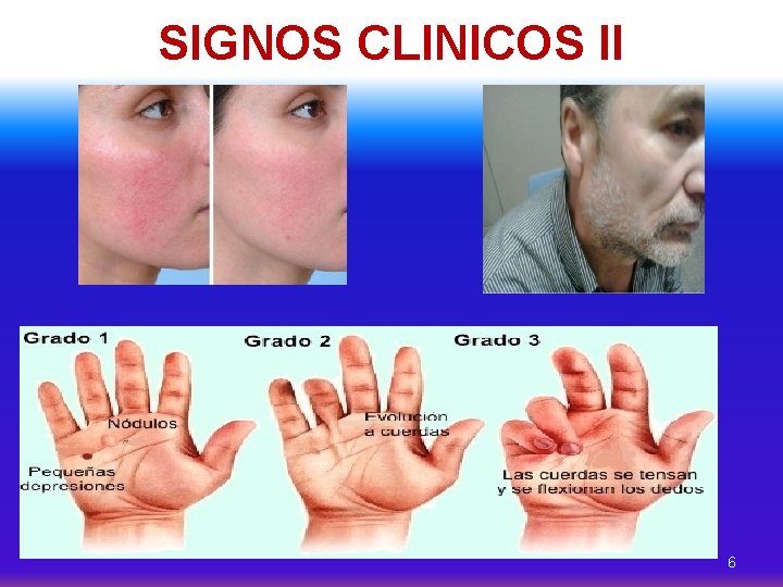 SIGNOS CLINICOS II 6 