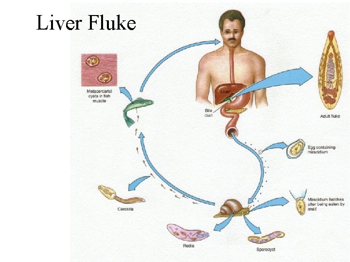 Liver Fluke 