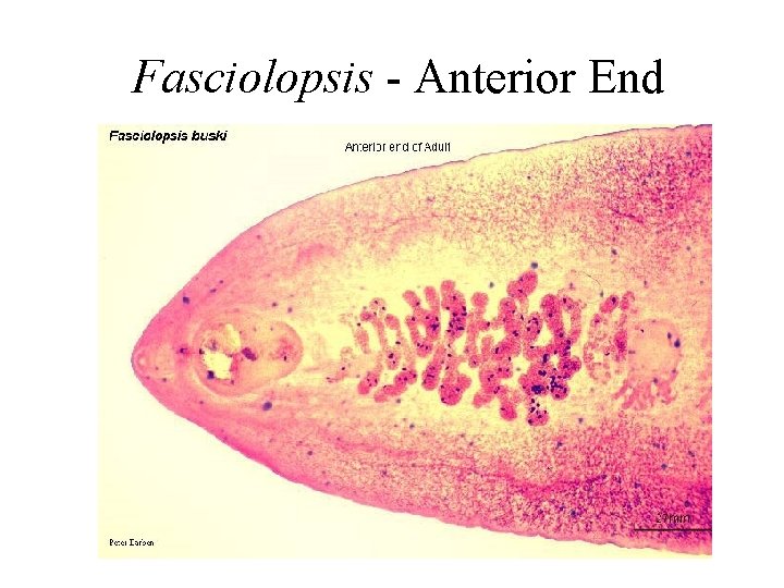 Fasciolopsis - Anterior End 