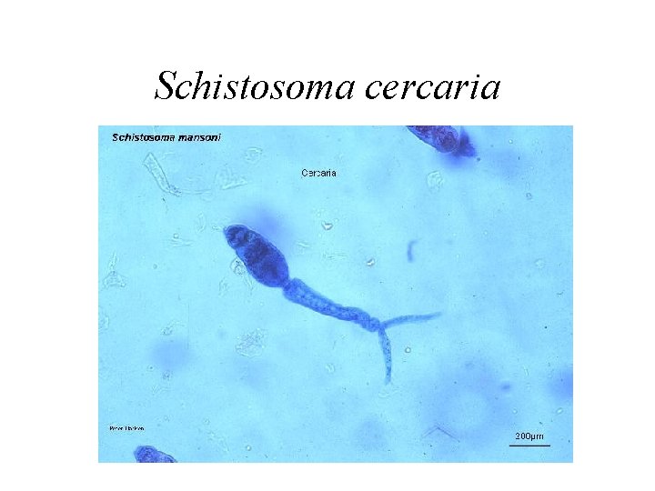 Schistosoma cercaria 