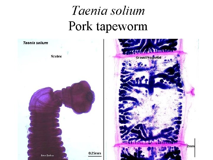 Taenia solium Pork tapeworm 