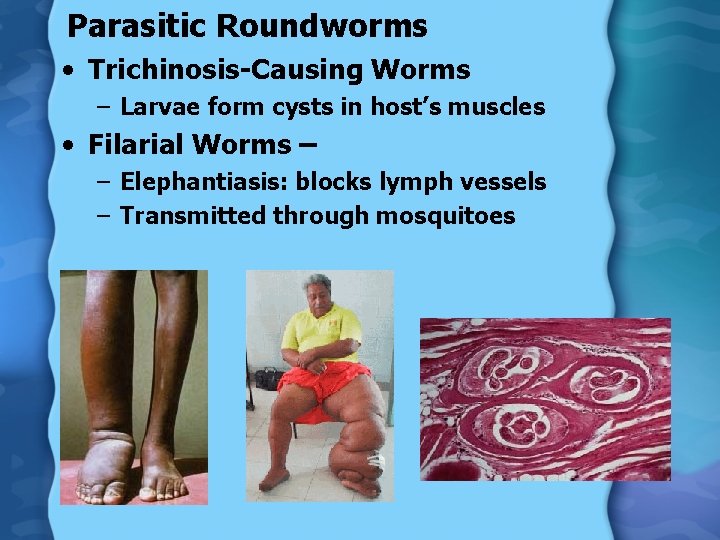 Parasitic Roundworms • Trichinosis-Causing Worms – Larvae form cysts in host’s muscles • Filarial