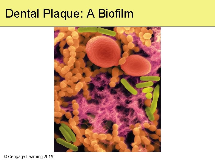 Dental Plaque: A Biofilm © Cengage Learning 2016 