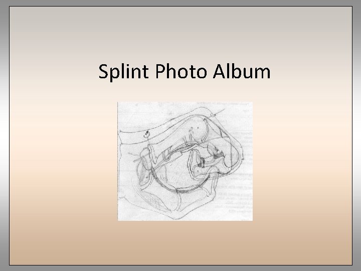 Splint Photo Album 