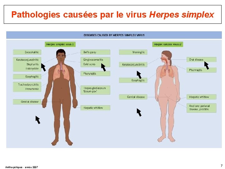 Pathologies causées par le virus Herpes simplex Antiherpétiques - année 2007 7 