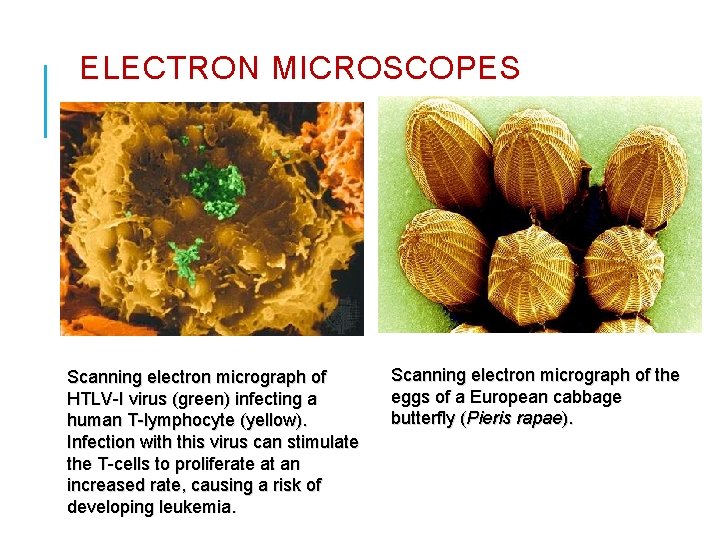 ELECTRON MICROSCOPES Scanning electron micrograph of HTLV-I virus (green) infecting a human T-lymphocyte (yellow).