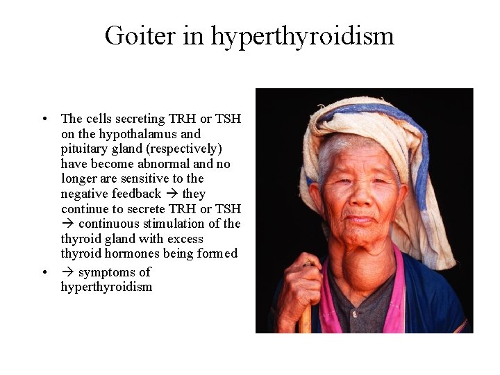 Goiter in hyperthyroidism • The cells secreting TRH or TSH on the hypothalamus and