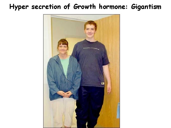 Hyper secretion of Growth hormone: Gigantism 