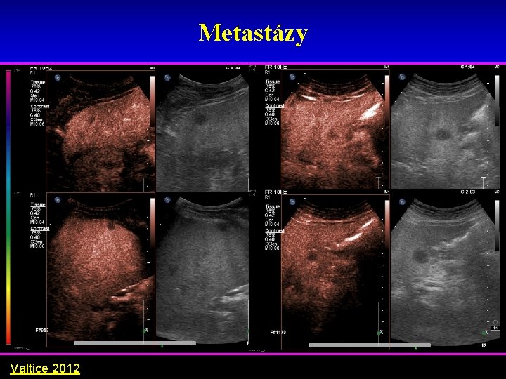 Metastázy Valtice 2012 