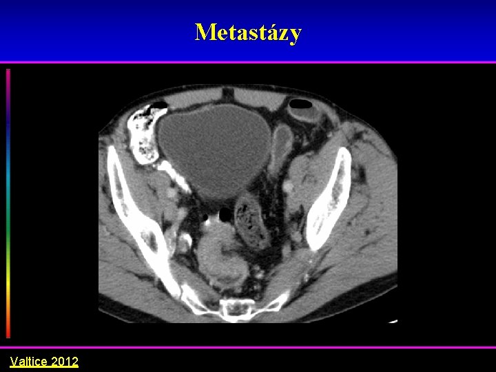 Metastázy Valtice 2012 