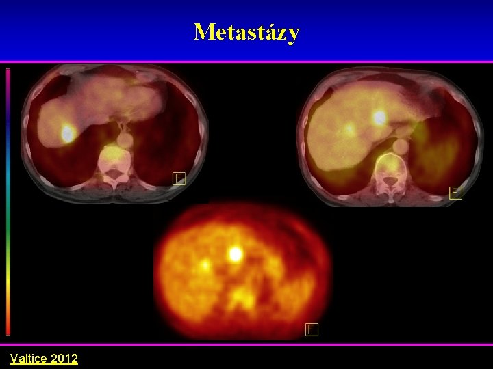 Metastázy Valtice 2012 