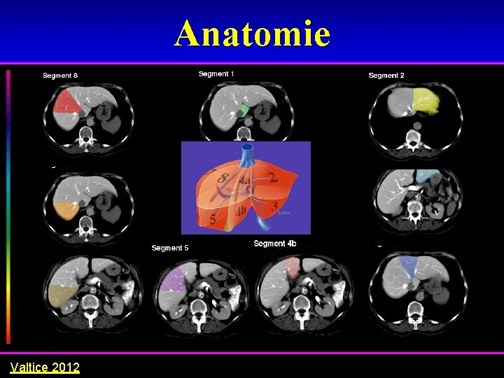 Anatomie Valtice 2012 