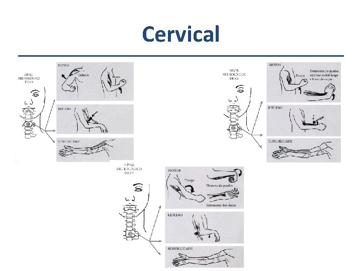 Cervical 