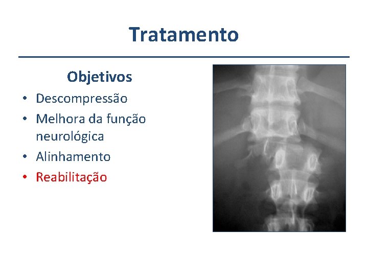 Tratamento Objetivos • Descompressão • Melhora da função neurológica • Alinhamento • Reabilitação 