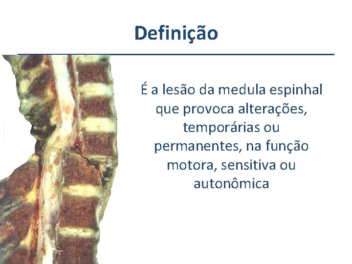 Definição É a lesão da medula espinhal que provoca alterações, temporárias ou permanentes, na