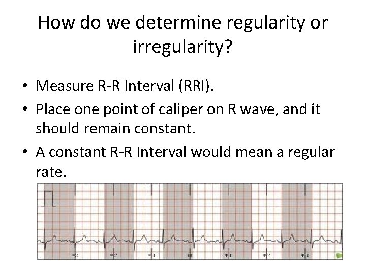 How do we determine regularity or irregularity? • Measure R-R Interval (RRI). • Place