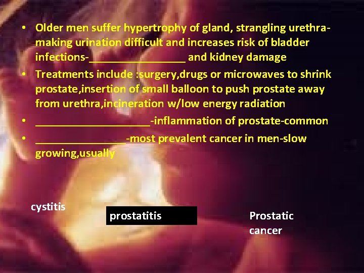 • Older men suffer hypertrophy of gland, strangling urethramaking urination difficult and increases • Older men suffer hypertrophy of gland, strangling urethramaking urination difficult and increases