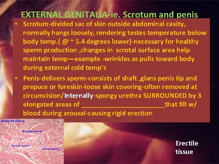 EXTERNAL GENITALIA-ie. Scrotum and penis • Scrotum-divided sac of skin outside abdominal cavity, normally EXTERNAL GENITALIA-ie. Scrotum and penis • Scrotum-divided sac of skin outside abdominal cavity, normally