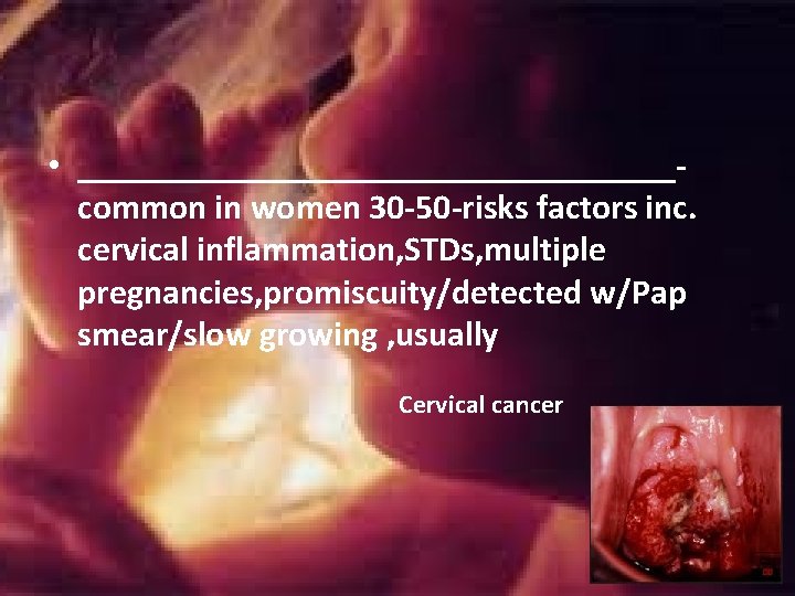 • _________________common in women 30 -50 -risks factors inc. cervical inflammation, STDs, multiple • _________________common in women 30 -50 -risks factors inc. cervical inflammation, STDs, multiple