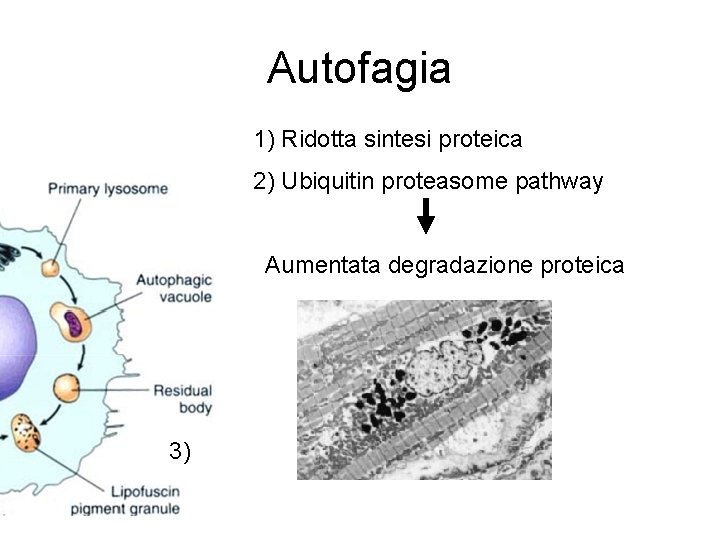 Autofagia 1) Ridotta sintesi proteica 2) Ubiquitin proteasome pathway Aumentata degradazione proteica 3) 