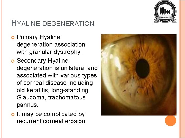 HYALINE DEGENERATION Primary Hyaline degeneration association with granular dystrophy. Secondary Hyaline degeneration is unilateral