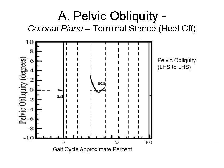A. Pelvic Obliquity Coronal Plane – Terminal Stance (Heel Off) 