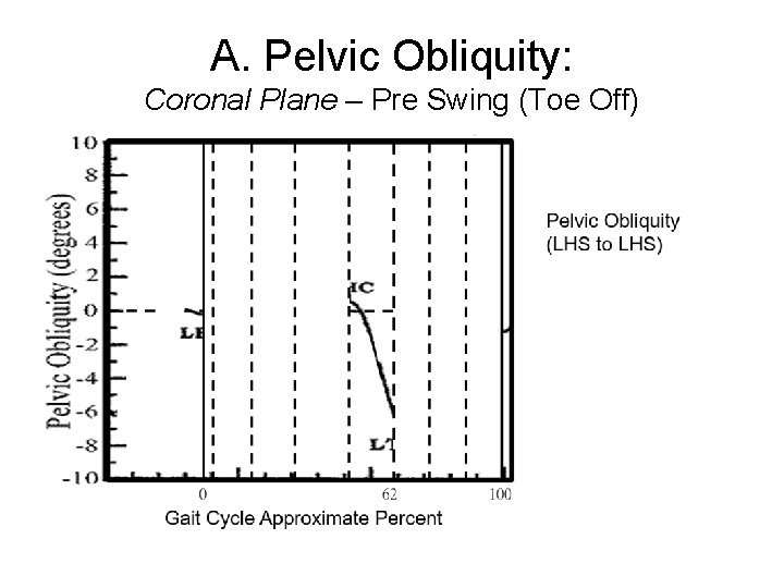 A. Pelvic Obliquity: Coronal Plane – Pre Swing (Toe Off) 