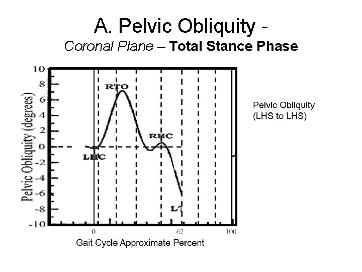 A. Pelvic Obliquity Coronal Plane – Total Stance Phase 